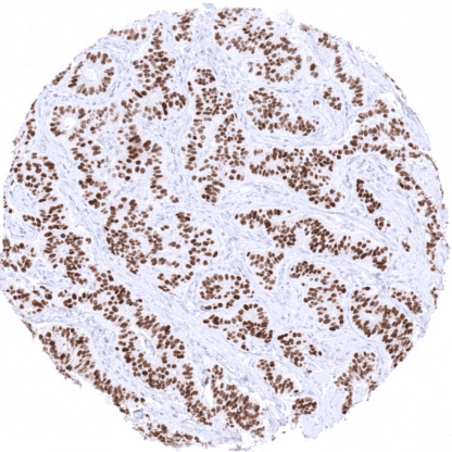 [sk1614] INSM1 (MSVA-456R)