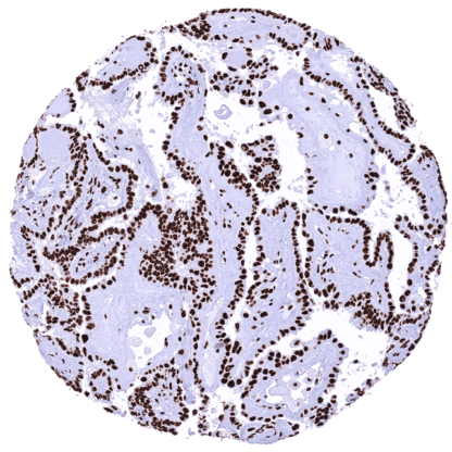 [sk1618] KAP1 / TRIM28 (HMV335)