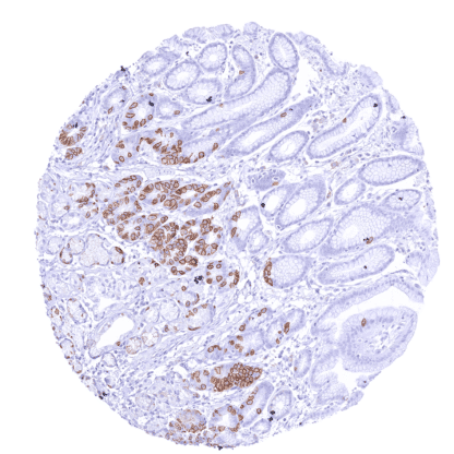 [sk1413] Claudin 3 (HMV309)