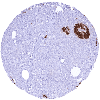 [sk1421] C-Peptide (HMV363)